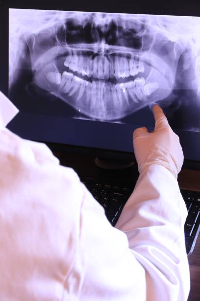Best Emergency Dentist for Knocked-Out Tooth in Bethlehem, PA